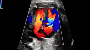Échographe Mindray DC-70, chariot vétérinaire Mindray, Doppler couleur 4D 3D, équipement d'échographie pour le diagnostic animal, pour clinique vétérinaire - Product Image 5