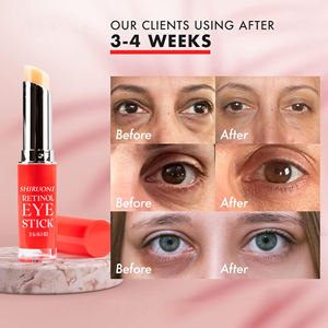 <span class=keywords><strong>Crema</strong></span> Contorno <span class=keywords><strong>Occhi</strong></span> Personalizzata al Bakuchiol per Occhiaie, Gonfiore, Linee Sottili, Rughe, <span class=keywords><strong>Borse</strong></span> Sotto gli <span class=keywords><strong>Occhi</strong></span>, Stick Balsamo <span class=keywords><strong>Occhi</strong></span> al Retinolo - Product Image 5