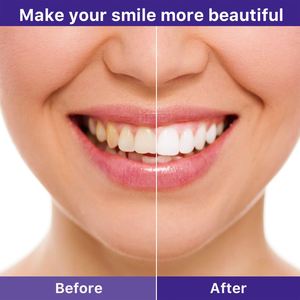 EELHOE Venta al por Mayor, Marca Privada, <span class=keywords><strong>Corrector</strong></span> de Color de Dientes con Extracto Natural de 30 ml, <span class=keywords><strong>V34</strong></span>, Mousse Blanqueadora de Dientes Púrpura, Elimina Manchas - Product Image 3