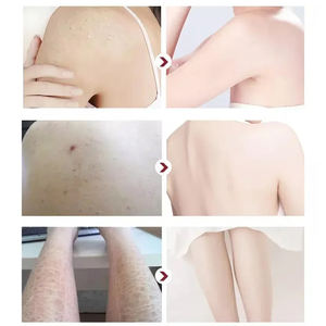 Productos para el Cuidado de la Piel de Marca Blanca, Loción Corporal Blanqueadora con Vitamina C, Hidratante Profunda - Product Image 6