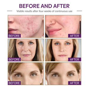 Marque privée Crème de papaye éclaircissante hydratante Crème pour le visage à l'extrait de papaye Crème de papaye éclaircissante hydratante 50ml - Product Image 4