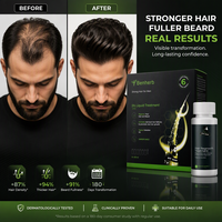 Minyak Rambut Herbal 60ml Biotin Rosemary Castor Jahe Kolagen Menutrisi Melembapkan Serum Kulit Kepala 2-in-1 untuk Pria