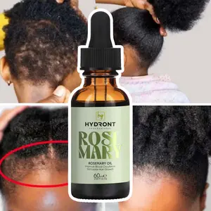Private Label naturale biologico olio essenziale di rosmarino per la crescita dei capelli olio per le donne di colore