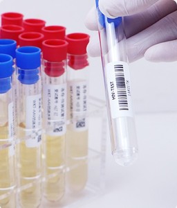 ฉลากกันน้ำแบบติดเอง ทนอุณหภูมิต่ำ เกรดสำหรับแช่แข็ง สำหรับห้องปฏิบัติการทางการแพทย์ วัคซีน และห่วงโซ่ความเย็น - Product Image 5