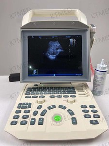 Zoncare Brand-i50, el Mejor y Más Económico Sistema de Ultrasonido Veterinario y Clínico en Blanco y Negro para Mascotas - Product Image 6