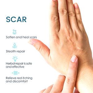 Krim penghilang bekas luka <span class=keywords><strong>Herbal</strong></span>, Krim penghilang Stretch Mark, perawatan perbaikan 20G, cepat - Product Image 6