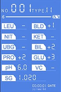 Tragbare Urin-Analyse-Maschine wiederaufladbarer Urin-Analysator mit Bluetooth und WLAN Tierarzt mit Drucker - Product Image 4