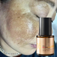 Sérum Chélatant Éclaircissant Anti-Taches pour le Visage, Élimine les Taches Noires et l'Hyperpigmentation dues aux Métaux Lourds