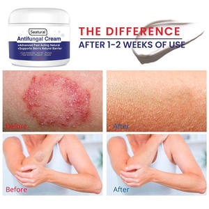 <span class=keywords><strong>ครีม</strong></span>ต้านเชื้อราสำหรับโรคผิวหนังอักเสบจากเชื้อรา ความแรงพิเศษ บรรเ<span class=keywords><strong>ทา</strong></span>อาการคันผิวหนังอย่างรวดเร็ว สำหรับโรคผิวหนังอักเสบจากเชื้อราบริเวณขาหนีบ และโรคเท้าอักเสบ - Product Image 4