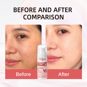 Crème éclaircissante à la vitamine C anti-taches <span class=keywords><strong>pour</strong></span> les taches brunes, le mélasma, le teint inégal, crème hydratante <span class=keywords><strong>pour</strong></span> le visage blanchissante - Product Image 6