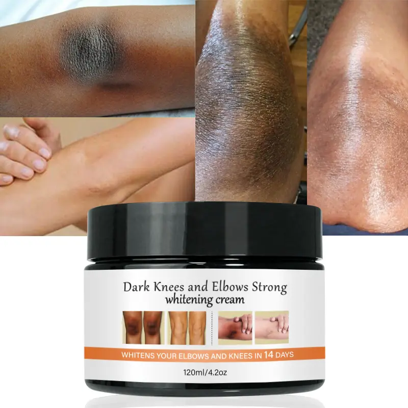 OEM Kojic Acid Cream Dark Knees And Elbows Strong Skin Lightening Fast Action Extreme Whitening Cream For Black Skin