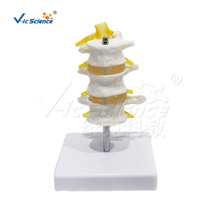 Modèle de vertèbres lombaires à trois segments de haute précision, en PVC, avec structure précise ; une démonstration de pathologie - Product Image 5