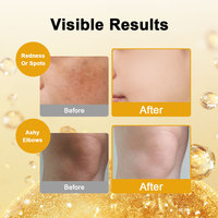 Sérum Vitamine C OEM Micro Tec Capsule, Sérum Illuminateur à la Vitamine, Éclaircissant avec Niacinamide, Renforce la Barrière Cutanée