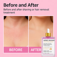 Sérum après-rasage à l'acide hyaluronique : Réduit les irritations, apaise les brûlures de rasoir, répare la barrière cutanée, hydrate – Soin du rasage matinal 100ml
