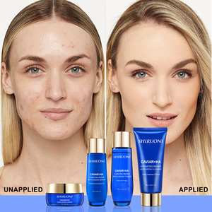 Ensemble de soins du visage pour femmes, caviar, nettoyage en profondeur des pores, hydratation longue durée, blanchiment, éclaircissement, biologique, végétalien, OEM ODM - Product Image 5