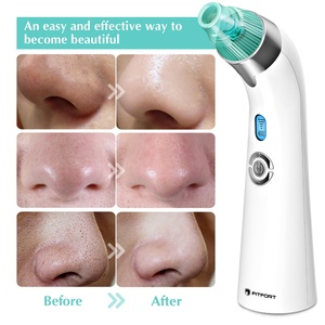 Removedor de Puntos Negros Eléctrico Recargable para Uso Doméstico, Limpieza Facial, Eliminación de Acné y Espinillas, Limpiador de Poros - Product Image 4