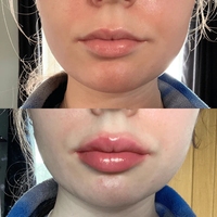Meilleur classement Gloss personnalisé pour les lèvres Vegan Candy Lip Plumper Gloss Private Label