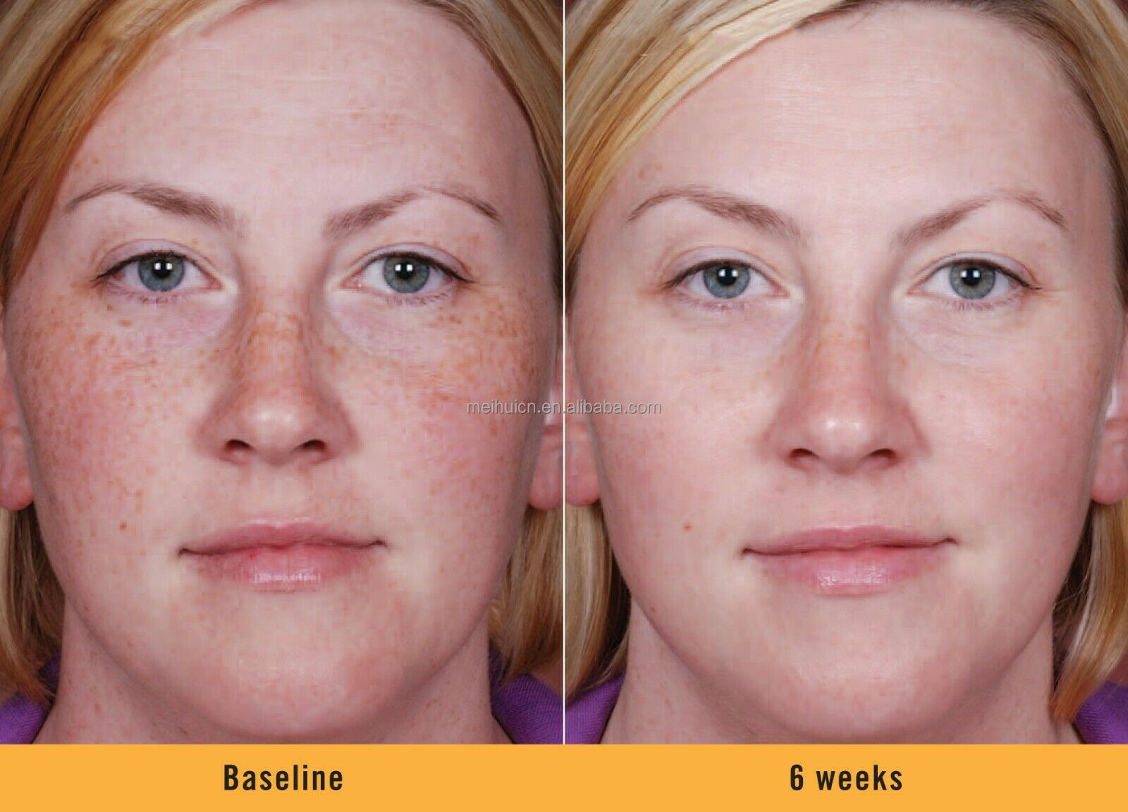 OEM Whitening Brightening Moisturizer Exfoliator Face Serum Face Scrub Face Oil Strawberry Skin Care Gift Set