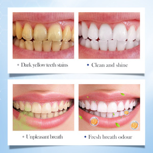 Rắn biểu tượng tùy chỉnh Probiotics kem đánh răng sử dụng hàng ngày vitamin tăng cường làm trắng màu vàng loại bỏ vết bẩn vẻ đẹp chăm sóc cá nhân - Product Image 2