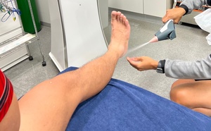 Dispositivo de Crioterapia con CO2 Premium, Dispositivo de Crioterapia con CO2, Enfriamiento Rápido e Indoloro para un Alivio Acelerado - Product Image 6