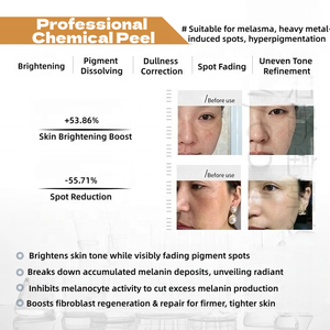 สารกำจัดฝ้าสำหรับผิวหน้าแบบมืออาชีพ, เซรั่มกำจัดคราบสารเคมี - Product Image 5