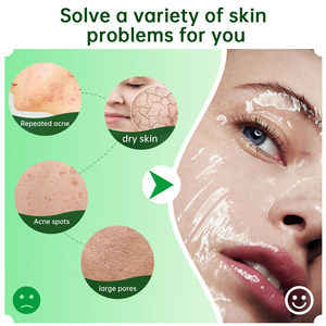 SEFUDUN Hidratante Suavizante Aceite reparador Control de <span class=keywords><strong>manchas</strong></span> de acné Tratamiento de poros grandes Gel <span class=keywords><strong>puro</strong></span> de <span class=keywords><strong>aloe</strong></span> <span class=keywords><strong>vera</strong></span> <span class=keywords><strong>para</strong></span> <span class=keywords><strong>cara</strong></span> y cuerpo - Product Image 5