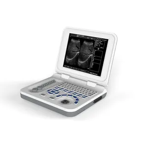UBW30 Easy Operation and Carring Laptop Type B & W Ultrasound Scanner with Built-in Li-battery