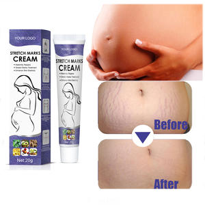 Crème d'élimination des vergetures réparatrice naturelle et biologique pour l'élimination des vergetures - Product Image 1