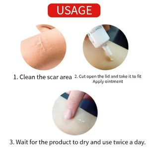 Crème anti-acné à l'acide salicylique de marque privée, élimine rapidement les cicatrices d'acné et resserre les pores, gel adapté à une utilisation quotidienne sur le visage - Product Image 5