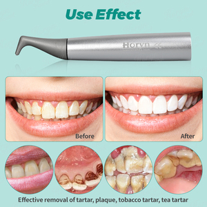 <span class=keywords><strong>Unit</strong></span>à dentale per la profia dell'aria con sbiancamento dei denti lucidatrice a spruzzo per il flusso di Airjet sabbiatura compatibile con la lucidatrice ad aria di <span class=keywords><strong>EMS</strong></span> - Product Image 3