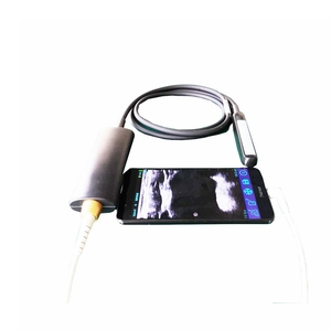Alat Pemindai USG Rektal USB Tipe B untuk Laptop dan Tablet - Product Image 2