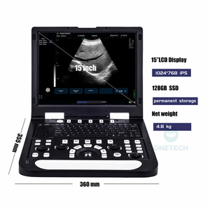 B53 giá thấp SONOSCAPE xách tay siêu âm DOPPLER Máy quét cho doanh số bán hàng - Product Image 5