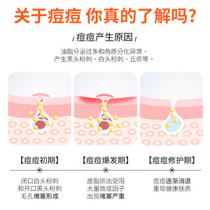 Parches para el acné con forma de corazón y estrella, 10 mm x 10 unidades, tratamiento para el acné, cuidado de la piel del rostro - Product Image 5