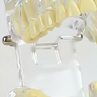 Modèle anatomique dentaire standard de pont amovible pour la restauration des dents, Typodont, Modèle de maladie implantaire, Matériau PVC, Vert, Science Médicale