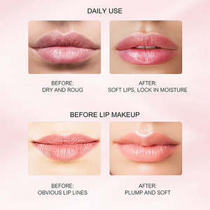 Proveedor de Productos para el Cuidado de Labios que Brindan Suavidad, Geles Labiales Hidratantes y Nutritivos, Bálsamo Labial en Crema - Product Image 4