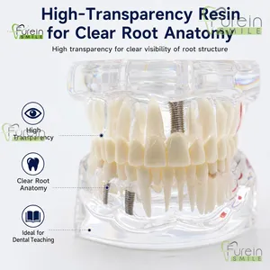 Modelo de Restauración Dental con Dientes Removibles, Implante, Corona y Puente, para Demostración y Estudio, para Educación y Entrenamiento de Dentistas - Product Image 6