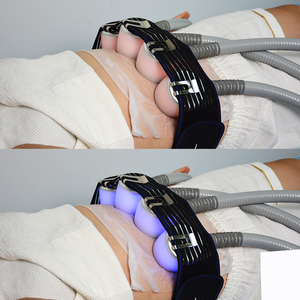 Cryo-face-máy Cryo bóng massage mặt cryoskin Cuộc Cách Mạng Trung Quốc da Bút công cụ mát mẻ kem giảm béo cơ thể điêu khắc - Product Image 6