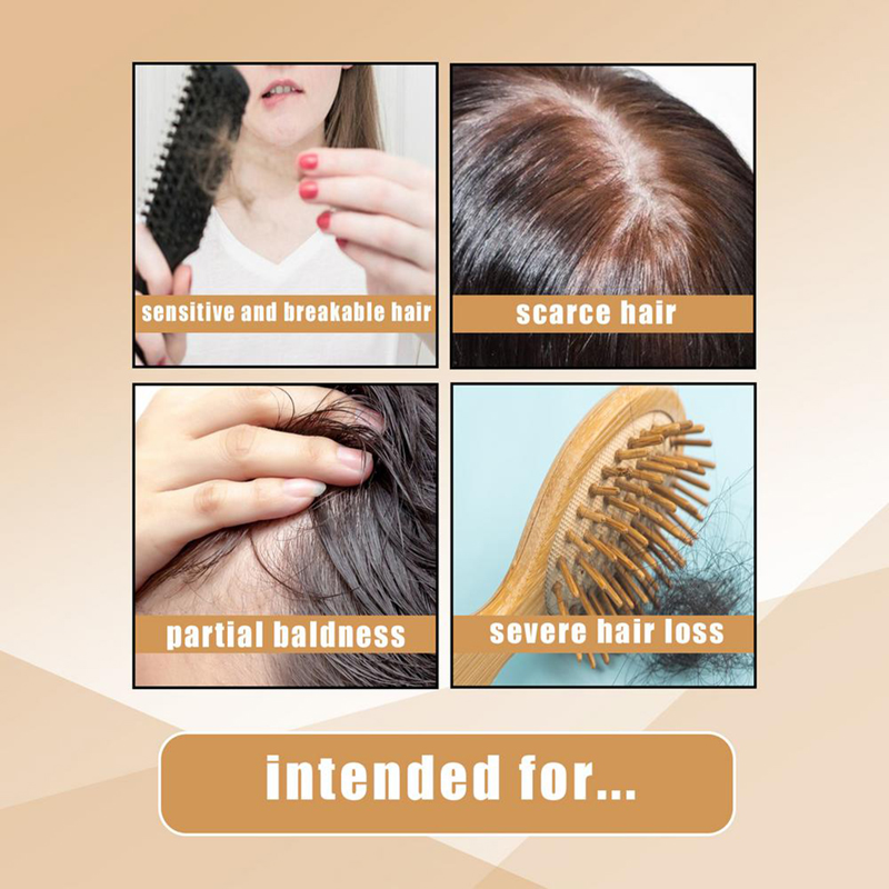 low moq natural ginger hair growth soap oil-control anti hair loss organic ginger soap growth shampoo