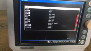 ใช้ได้กับ VS2 vm4 vm6 vm8 vm3 VS3 v24e M6จอภาพแบตเตอรี่ใช้ได้กับ <span class=keywords><strong>Philips</strong></span> - Product Image 3