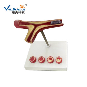 Modelo cardiovascular humano, modelo de trombosis patológica - Product Image 5
