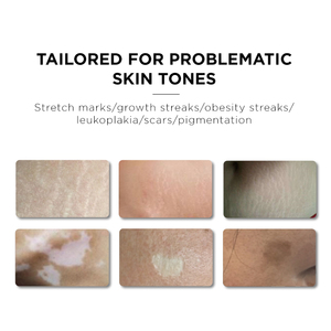 OEM Logo Peau PMU Pigmentation Couverture Vitiligo Vergetures Enlèvement Camouflage pour Jambes Visage Cicatrices Sans Pigment de Maquillage Permanent - Product Image 3