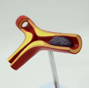 Model Pembelajaran arteri SCIEDU Model pengajaran sumber daya gray Anatomy manusia Model penyakit arteri koroner - Product Image 6