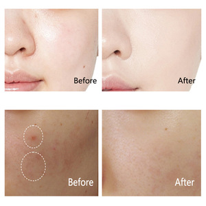 Marque privée Soins de la peau du visage Crème <span class=keywords><strong>miracle</strong></span> au rétinol Hydratant bio Crème visage éclatante éclaircissante anti-âge anti-<span class=keywords><strong>rides</strong></span> - Product Image 4