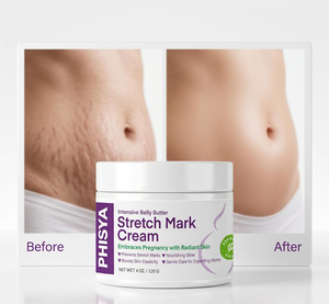 Crème anti-vergetures et cicatrices sans parabènes pour la prévention des vergetures de grossesse, atténue les vergetures de grossesse - Product Image 4