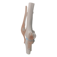 Science médicale arthrose anatomie pathologique PVC artificiel flexible taille réelle squelette humain modèle anatomique de l'articulation du genou