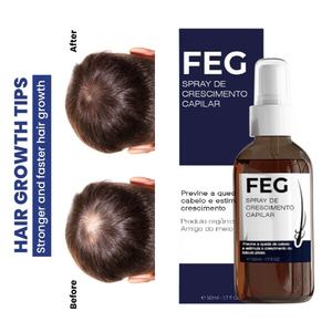 Gratis sampel perawatan kepala botak YUDA dan FEG penumbuh ulang rambut, perawatan rambut rontok baru ANTI kit semprotan rambut rontok - Product Image 4