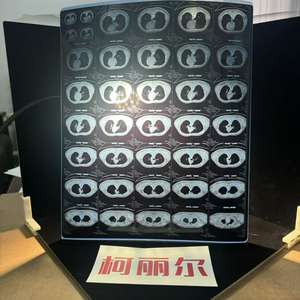 <span class=keywords><strong>Film</strong></span> laser radiographique médical, taille 14x17, bleu, personnalisable, haute qualité, matériau PET transparent, épaisseur 175, adhésif pour l'emballage - Product Image 3