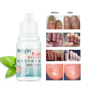 10ml onychomycose paronychie Anti-infection crème de traitement des ongles tue 99.9% bactéries champignon gel de soin des ongles fongiques - Product Image 6