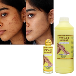 Marque privée Acide kojique Vitamine c Sérum Concentré Produits de soins de la peau coréens 1000ml Sérum <span class=keywords><strong>Anti</strong></span> Tache Sérum super blanchissant pour le visage - Product Image 1