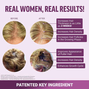 Gummies pour la croissance des <span class=keywords><strong>cheveux</strong></span> OEM/ODM, saveur fruits rouges, avec biotine et Lustriva, efficacité en 3 semaines, <span class=keywords><strong>complément</strong></span> <span class=keywords><strong>alimentaire</strong></span> anti-chute et <span class=keywords><strong>repousse</strong></span> des <span class=keywords><strong>cheveux</strong></span> - Product Image 2